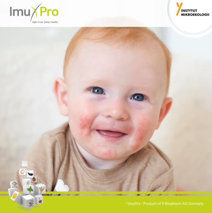 imupro_azs