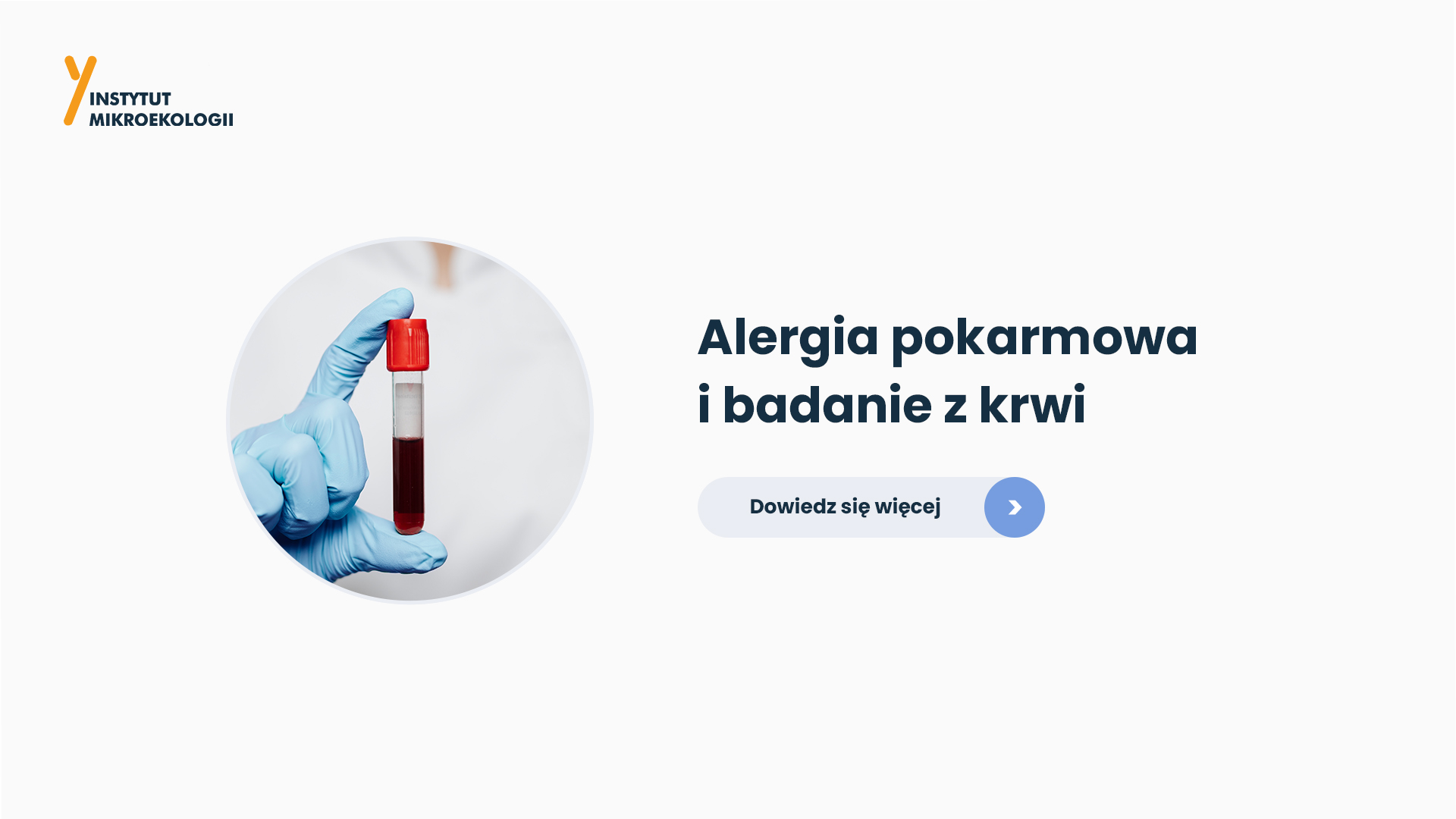 alergia_badanie_z_krwi_blog